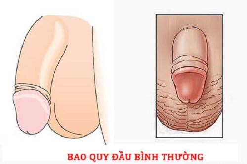 Bao quy đầu bình thường 